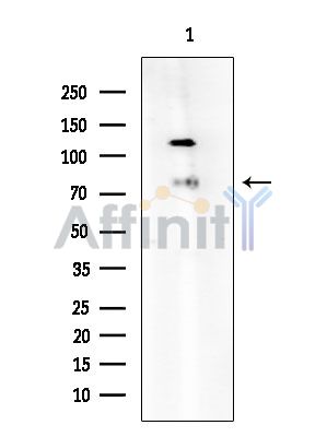TCF4 Antibody - Western blot analysis of extracts from COLO205 cells(heat-shock treatment), using TCF4 Antibody at 1/1000 dilution.