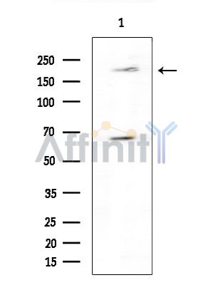 WNK3 Antibody - Western blot analysis of extracts from Rat brain, using WNK3 Antibody at 1/1000 dilution.