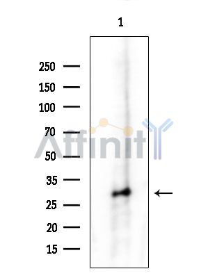 PSMB4 Antibody - Western blot analysis of extracts from COLO205 cells(heat-shock treatment), using PSMB4 Antibody at 1/1000 dilution.