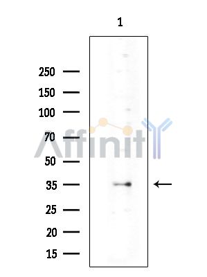 RHOQ Antibody - Western blot analysis of extracts from EC304 cells(heat-shock treatment), using RHOQ Antibody at 1/1000 dilution.