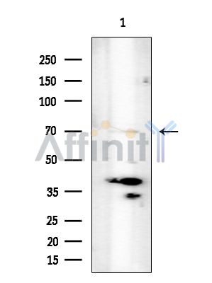 SUN2 Antibody - Western blot analysis of extracts from COLO205 cells(heat-shock treatment), using SUN2 Antibody at 1/1000 dilution.