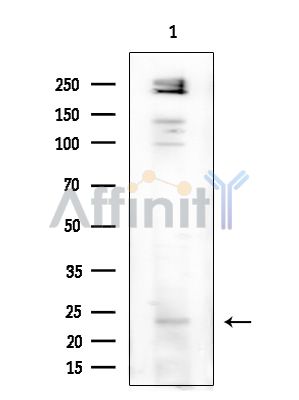 MED28 Antibody - Western blot analysis of extracts from COLO205 cells(heat-shock treatment), using MED28 Antibody at 1/1000 dilution.
