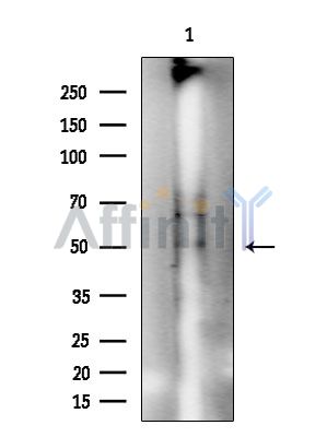 Phospho-NCF1/p47-phox (Ser359) Antibody - Western blot analysis of extracts from COLO205 cells(heat-shock treatment), using Phospho-NCF1/p47-phox (Ser359) Antibody at 1/1000 dilution.