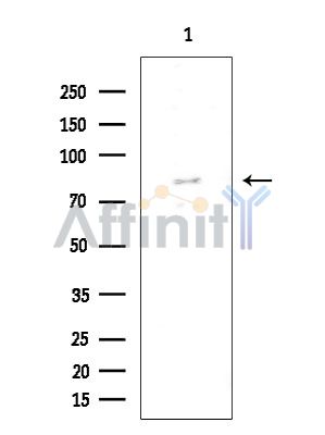 FOXP1 Antibody - Western blot analysis of extracts from various samples, using FOXP1 Antibody at 1/1000 dilution.