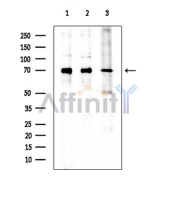 NF-kB p65 Antibody - Western blot analysis of extracts from various samples, using NF-kB p65 Antibody at 1/1000 dilution.