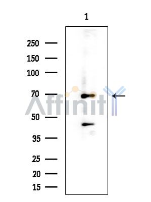 NF-kB p65 Antibody - Western blot analysis of extracts from EC304 cells(heat-shock treatment), using NF-kB p65 Antibody at 1/1000 dilution.