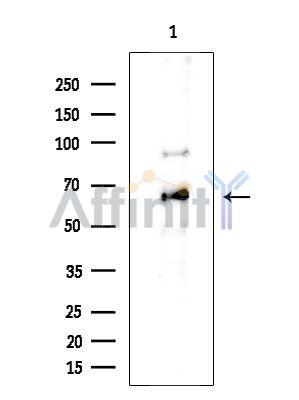 NF-kB p65 Antibody - Western blot analysis of extracts from COLO205 cells(heat-shock treatment), using NF-kB p65 Antibody at 1/1000 dilution.