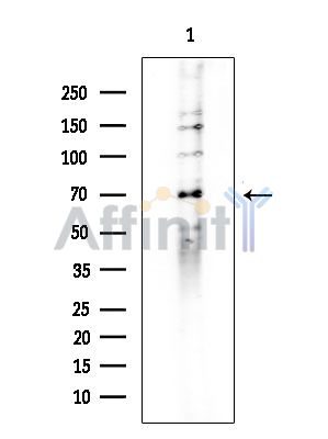 NF-kB p65 Antibody - Western blot analysis of extracts from Rat brain, using NF-kB p65 Antibody at 1/1000 dilution.