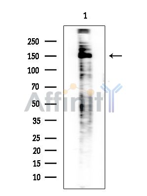 ULK1 Antibody - Western blot analysis of extracts from Rat brain, using ULK1 Antibody at 1/1000 dilution.