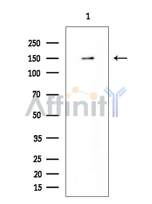 DEF-3 Antibody - Western blot analysis of extracts from COLO205 cells(heat-shock treatment), using DEF-3 Antibody at 1/1000 dilution.