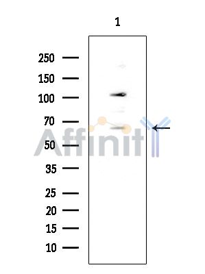 C-RAF Mouse Monoclonal Antibody - Western blot analysis of extracts from EC304 cells, using C-RAF Mouse Monoclonal Antibody at 1/1000 dilution.
