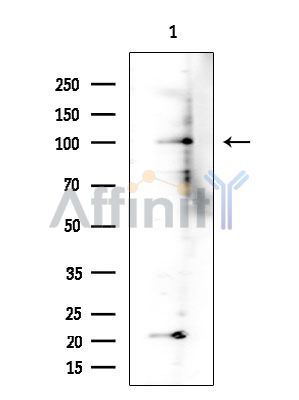 ATP6V0A2 Antibody - Western blot analysis of extracts from Rat brain, using ATP6V0A2 Antibody at 1/1000 dilution.