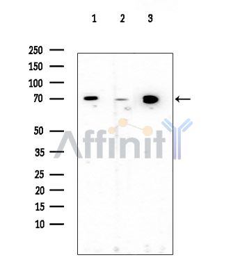 UL97 Antibody - Western blot analysis of extracts from various samples, using UL97 Antibody at 1/1000 dilution.