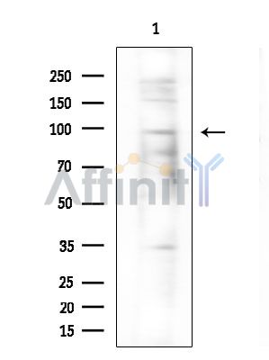ZNF786 Antibody - Western blot analysis of extracts from COLO205 cells(heat-shock treatment), using ZNF786 Antibody at 1/1000 dilution.