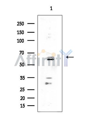 LZTR1 Antibody - Western blot analysis of extracts from COLO205 cells(heat-shock treatment), using LZTR1 Antibody at 1/1000 dilution.