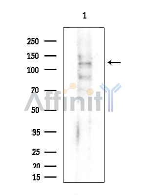 ITGAM Antibody - Western blot analysis of extracts from Mouse testis, using ITGAM Antibody at 1/1000 dilution.