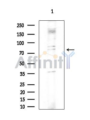DDX51 Antibody - Western blot analysis of extracts from COLO205 cells(heat-shock treatment), using DDX51 Antibody at 1/1000 dilution.