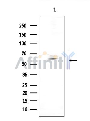 CSPG5 Antibody - Western blot analysis of extracts from COLO205 cells(heat-shock treatment), using CSPG5 Antibody at 1/1000 dilution.