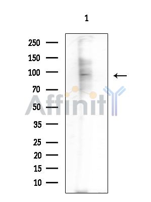 N4BP1 Antibody - Western blot analysis of extracts from Mouse testis, using N4BP1 Antibody at 1/1000 dilution.