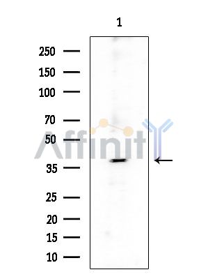 SH2D5 Antibody - Western blot analysis of extracts from COLO205 cells(heat-shock treatment), using SH2D5 Antibody at 1/1000 dilution.