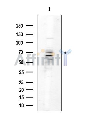 SLC5A2 Antibody - Western blot analysis of extracts from COLO205 cells(heat-shock treatment), using SLC5A2 Antibody at 1/1000 dilution.