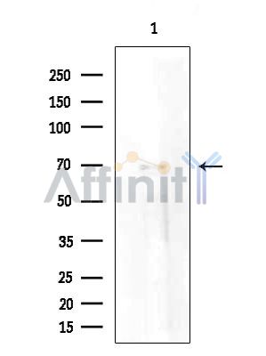 SYTL4 Antibody - Western blot analysis of extracts from EC304 cells(heat-shock treatment), using SYTL4 Antibody at 1/1000 dilution.