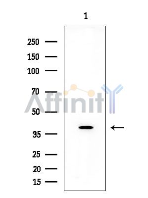 OR2A4/7 Antibody - Western blot analysis of extracts from EC304 cells, using OR2A4/7 Antibody at 1/1000 dilution.