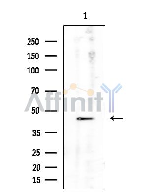 CD86 Antibody - Western blot analysis of extracts from EC304 cells, using CD86 Antibody at 1/1000 dilution.