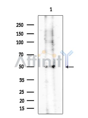 KLK2 Antibody - Western blot analysis of extracts from Mouse testis, using KLK2 Antibody at 1/1000 dilution.