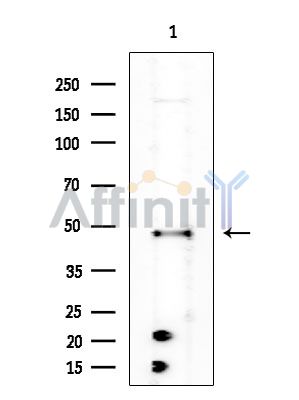 KLK2 Antibody - Western blot analysis of extracts from COLO205 cells(heat-shock treatment), using KLK2 Antibody at 1/1000 dilution.
