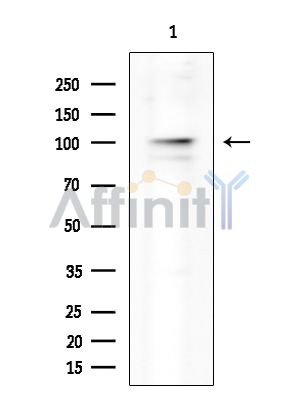 NLRP3 Antibody - Western blot analysis of extracts from EC304 cells(heat-shock treatment), using NLRP3 Antibody at 1/1000 dilution.