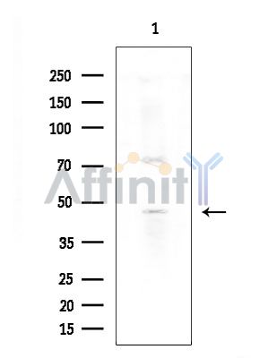 CYP3A5 Antibody - Western blot analysis of extracts from COLO205 cells(heat-shock treatment), using CYP3A5 Antibody at 1/1000 dilution.