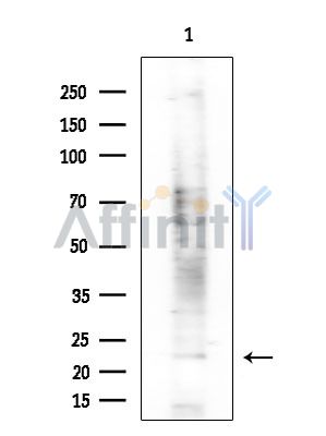 EBI3 Antibody - Western blot analysis of extracts from COLO205 cells(heat-shock treatment), using EBI3 Antibody at 1/1000 dilution.