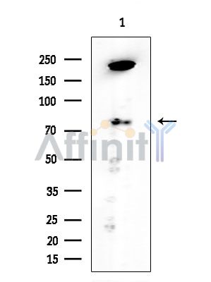 PROX1 Antibody - Western blot analysis of extracts from COLO205 cells(heat-shock treatment), using PROX1 Antibody at 1/1000 dilution.