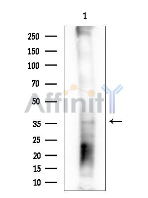 OLIG1 Antibody - Western blot analysis of extracts from EC304 cells(heat-shock treatment), using OLIG1 Antibody at 1/1000 dilution.