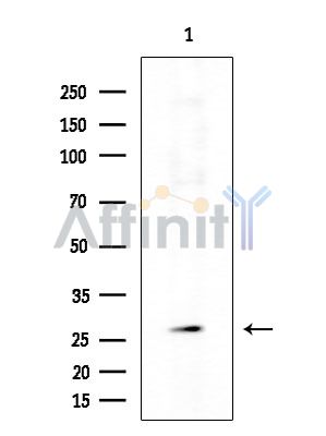 OR9G1 Antibody - Western blot analysis of extracts from COLO205 cells(heat-shock treatment), using OR9G1 Antibody at 1/1000 dilution.