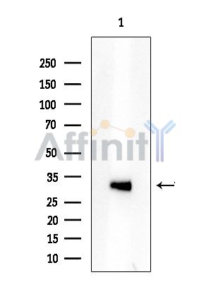 ATXN7L3 Antibody - Western blot analysis of extracts from COLO205 cells(heat-shock treatment), using ATXN7L3 Antibody at 1/1000 dilution.