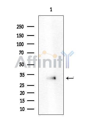 ATXN7L3 Antibody - Western blot analysis of extracts from EC304 cells(heat-shock treatment), using ATXN7L3 Antibody at 1/1000 dilution.