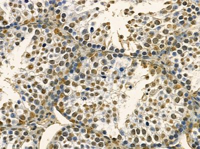MKK3/MKK6 Mouse Monoclonal Antibody - BF8429 at 1/100 staining mouse testis tissue by IHC-P.