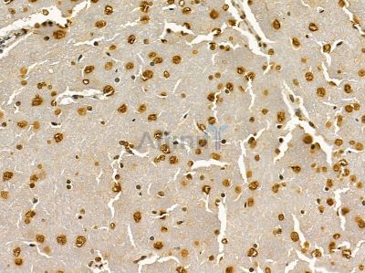 MKK3/MKK6 Mouse Monoclonal Antibody - BF8429 at 1/100 staining rat brain tissue by IHC-P.