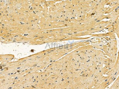 C-RAF Mouse Monoclonal Antibody - BF8494 at 1/100 staining mouse heart tissue by IHC-P.