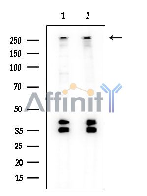 CUL9 Antibody - Western blot analysis of extracts from various samples, using CUL9 Antibody.