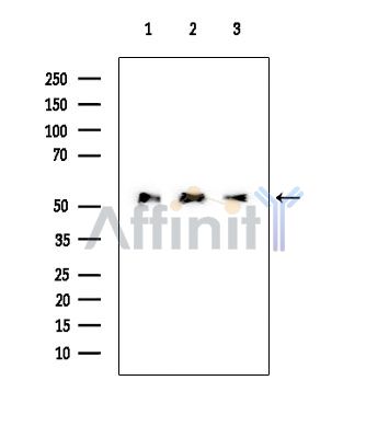 p53 Mouse Monoclonal Antibody - Western blot analysis of extracts from various samples, using p53 Mouse Monoclonal Antibody at 1/1000 dilution.