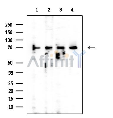 MTHFR Mouse Monoclonal Antibody - Western blot analysis of extracts from various samples, using MTHFR Mouse Monoclonal Antibody at 1/1000 dilution.