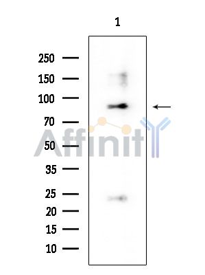 ATP6V0A4 Mouse Monoclonal Antibody - Western blot analysis of extracts from Mouse testis, using ATP6V0A4 Mouse Monoclonal Antibody at 1/1000 dilution.