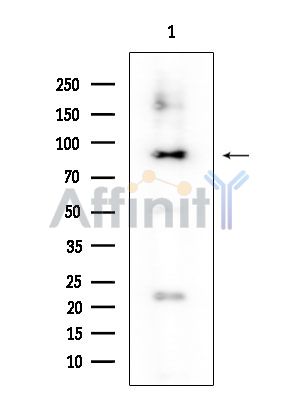 ATP6V0A4 Mouse Monoclonal Antibody - Western blot analysis of extracts from Rat brain, using ATP6V0A4 Mouse Monoclonal Antibody at 1/1000 dilution.