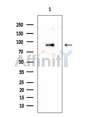 ATP6V0A4 Mouse Monoclonal Antibody - Western blot analysis of extracts from EC304 cells, using ATP6V0A4 Mouse Monoclonal Antibody at 1/1000 dilution.