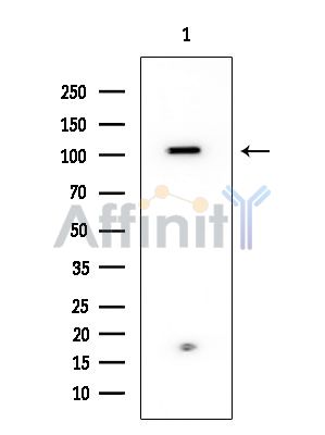 EPS15 Mouse Monoclonal Antibody - Western blot analysis of extracts from HUVEC cells, using EPS15 Mouse Monoclonal Antibody at 1/1000 dilution.