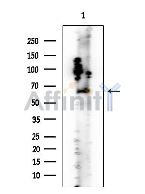Alanine Transaminase Mouse Monoclonal Antibody - Western blot analysis of extracts from Rat lung, using Alanine Transaminase Mouse Monoclonal Antibody at 1/1000 dilution.