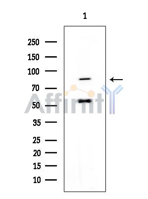 GluR6 Mouse Monoclonal Antibody - Western blot analysis of extracts from EC304 cells, using GluR6 Mouse Monoclonal Antibody at 1/1000 dilution.